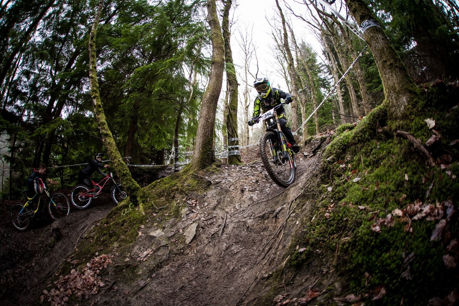 Waspadai Tanda-tanda dari Cedera Serius Saat Lo Melakukan Downhill!