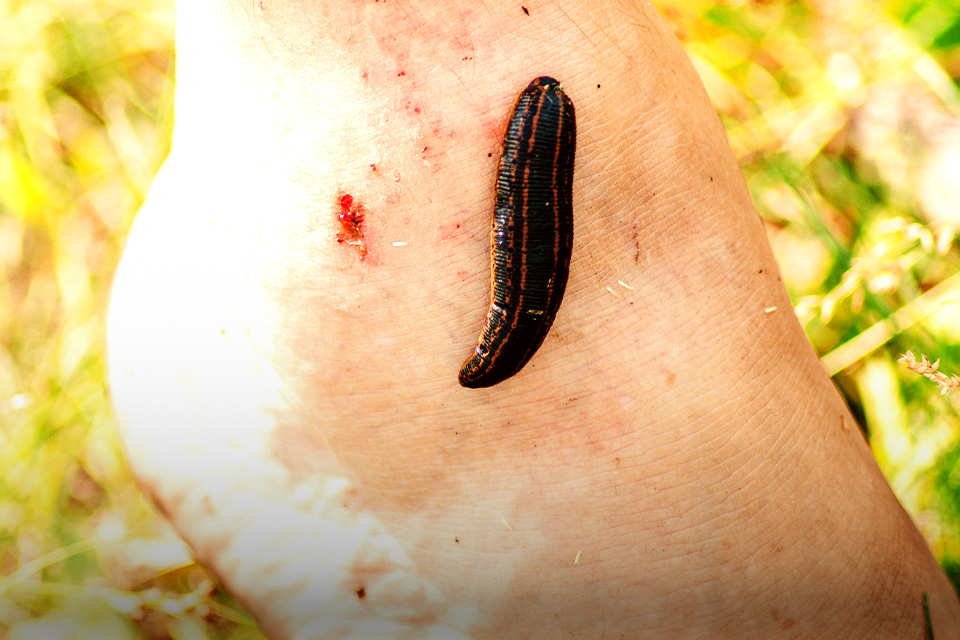 Digigit Lintah Saat Naik Gunung, Begini Lho Bro Cara Menanganinya 